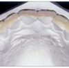 Các phương pháp giảm đau do mọc răng khôn