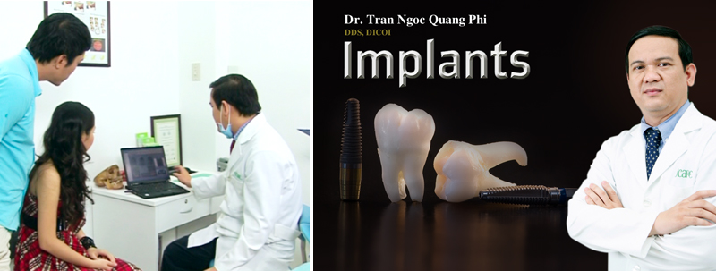 Trồng răng giả Implant tại Nha Khoa O'CARE